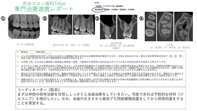 歯内療法科と連携し作製した連携レポート