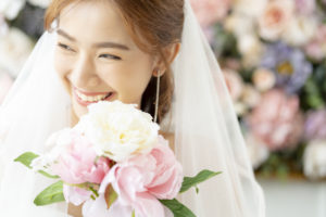 【症例】結婚式を控えた20代女性の前歯の審美治療｜花嫁の笑顔のイメージ｜渋谷の歯医者 渋谷マロン歯科Tokyo