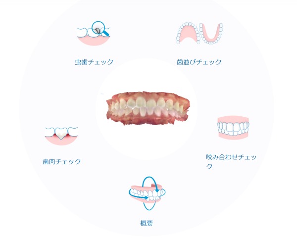 口腔内スキャンで行う5つの詳細検査｜渋谷の歯医者「渋谷マロン歯科Tokyo」