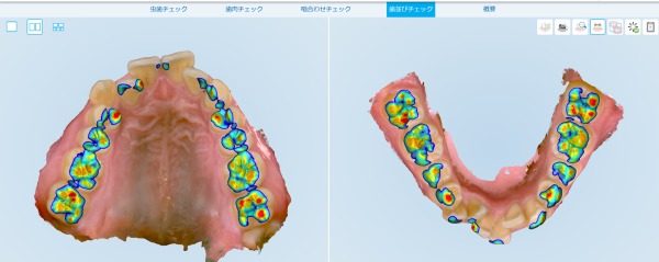 歯並びチェック｜知覚過敏と虫歯の違いとは？歯がしみる原因と見分け方｜渋谷の歯医者なら渋谷マロン歯科Tokyo