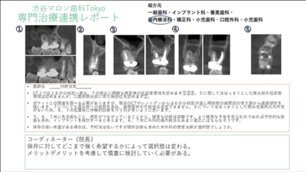 専門家による実際のレポート｜【症例】右下６臼歯部抜歯即時インプラント埋入｜渋谷の歯医者｜渋谷マロン歯科Tokyo