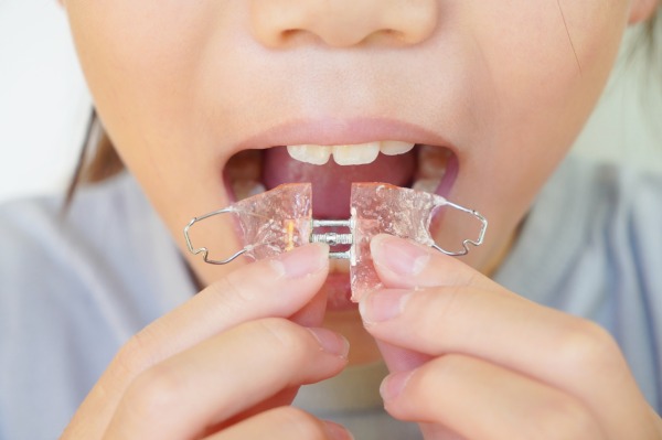 小児矯正器具を装着しようとしている子ども｜小児矯正は何歳から始める？ベストなタイミングと費用の目安｜渋谷の歯医者なら渋谷マロン歯科Tokyo